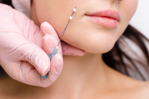 PDO Threads vs Botox: Which is the Best Anti-Aging Treatment?