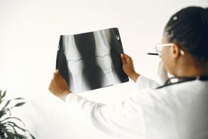 Platelet-Rich Plasma (PRP) Orthopedic: Advancements in Orthopedic Treatments